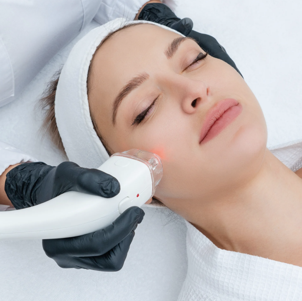depilación laser cara