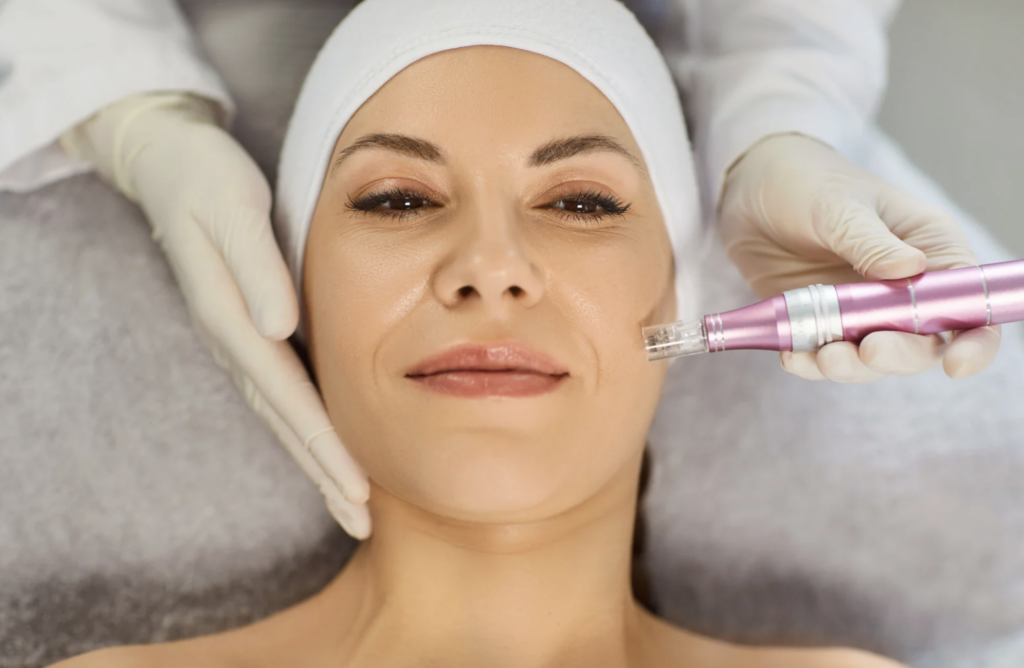 dermapen ( microneelding) con lift tense
